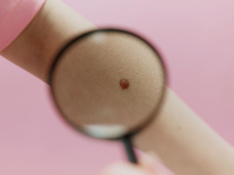 devojka pregleda mladeže sa lupom na ruci